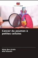 Wala Ben Kridis, Afef Khanfir - Cancer du poumon à petites cellules, Häftad. Tillgänglighet: Lägg i varukorg