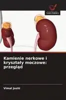 Kamienie nerkowe i krysztaly moczowe