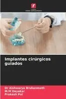 Implantes cirúrgicos guiados