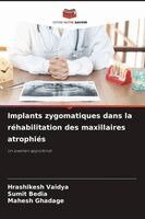 Hrashikesh Vaidya, Sumit Bedia, Mahesh Ghadage - Implants zygomatiques dans la réhabilitation des maxillaires atrophiés, Häftad
