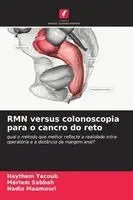 Haythem Yacoub, Mériam Sabbah, Nadia Maamouri - RMN versus colonoscopia para o cancro do reto, Häftad. Tillgänglighet: Lägg i varukorg