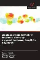 Yaser Hosni, Ahmad Hasan, Raafat Ragab - Zastosowanie klatek w leczeniu choroby zwyrodnieniowej krążków szyjnych, Häftad. Tillgänglighet: Lägg i varukorg