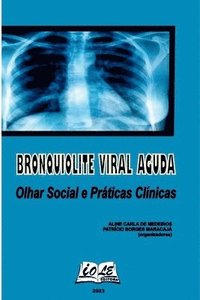 bokomslag Bronquiolite Viral Aguda