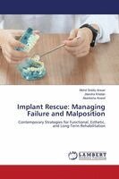 Mohd Siddiq Ansari, Jitendra Khetan, Akanksha Anand - Implant Rescue, Häftad