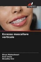 Divya Maheshwari, Arun Urala, Nivedita Kini - Eccesso mascellare verticale, Häftad. Tillgänglighet: Lägg i varukorg