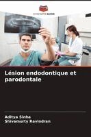 Aditya Sinha, Shivamurty Ravindran - Lésion endodontique et parodontale, Häftad. Tillgänglighet: Lägg i varukorg