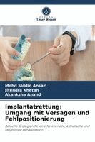 Mohd Siddiq Ansari, Jitendra Khetan, Akanksha Anand - Implantatrettung, Häftad