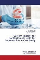 Santosh Jaju, Sachin Untawale, Nilesh Nirwan - Custom Implant for NonRestorable teeth for improved life, Häftad