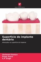 Shrimant Raman, Pooja Arora, S P Singh - Superfície do implante dentário, Häftad. Tillgänglighet: Lägg i varukorg