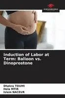 Dhekra Toumi, Hela Mtir, Islem Naceur - Induction of Labor at Term, Häftad. Tillgänglighet: Lägg i varukorg