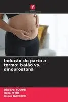 Dhekra Toumi, Hela Mtir, Islem Naceur - Indução do parto a termo, Häftad. Tillgänglighet: Lägg i varukorg