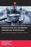 Komal Sharma, Vineetha R, Puneeta Vohra - Osteonecrose das mandíbulas induzida por bisfosfonatos, Häftad. Tillgänglighet: Lägg i varukorg
