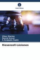 Vikas Sharma, Neeraj Grover, S SenGupta Gupta - Riesenzell-Läsionen, Häftad. Tillgänglighet: Lägg i varukorg