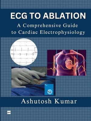 bokomslag ECG to Ablation: A Comprehensive Guide to Cardiac Electrophysiology