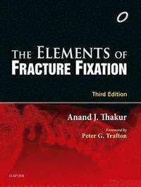 bokomslag Elements of Fracture Fixation