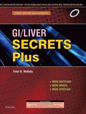 Peter R. McNally - GI/Liver Secrets Plus: First South Asia Edition, Häftad