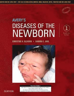 bokomslag Avery's Diseases of the Newborn: First South Asia Edition