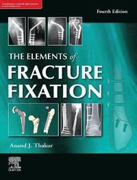 bokomslag The elements of fracture fixation, 4e