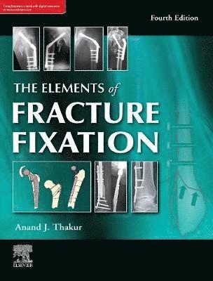 The elements of fracture fixation, 4e 1