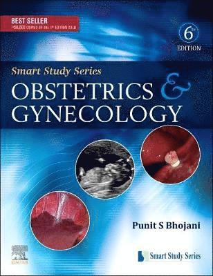 Smart Study Series:Obstetrics & Gynecology 1