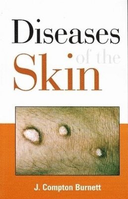 J Compton Burnett - Diseases of the Skin, Häftad