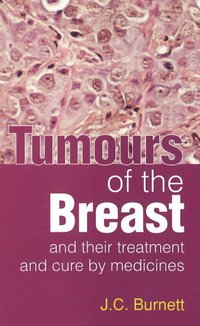 bokomslag Tumours of the Breast