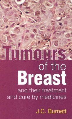 Tumours of the Breast 1