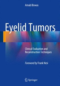 bokomslag Eyelid Tumors