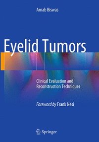 bokomslag Eyelid Tumors