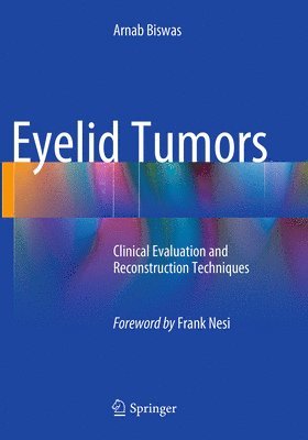 Eyelid Tumors 1