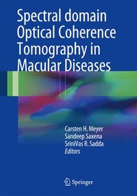 bokomslag Spectral Domain Optical Coherence Tomography in Macular Diseases