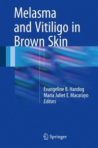 bokomslag Melasma and Vitiligo in Brown Skin