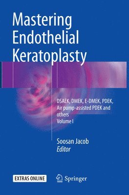 Soosan Jacob - Mastering Endothelial Keratoplasty, Häftad