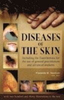 bokomslag Diseases of the Skin