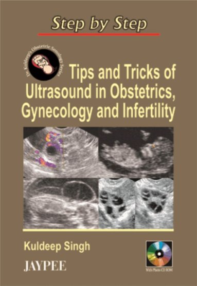 Kuldeep Singh - Step by Step: Tips & Tricks of Ultrasound in Obstetrics, Gynecology & Infertility, Häftad