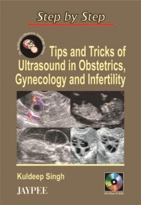 Step by Step: Tips & Tricks of Ultrasound in Obstetrics, Gynecology & Infertility 1