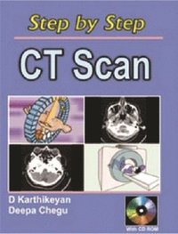 bokomslag Step by Step CT Scan