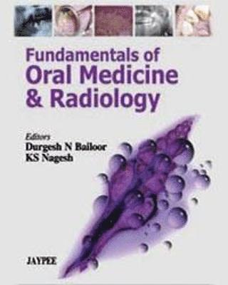Durgesh M Bailoor, KS Nagesh - Fundamentals of Oral Medicine and Radiology, Inbunden
