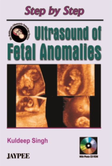 Kuldeep Singh - Step by Step Ultrasound of Fetal Anomalies, Häftad
