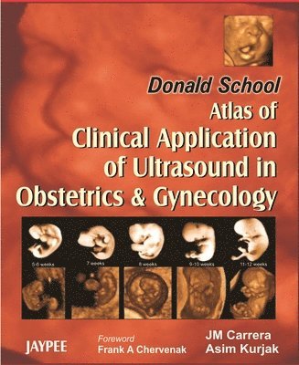 JM Carrera, Asim Kurjak - Donald School Atlas of Clinical Application of Ultrasound in Obstetrics & Gynecology, Inbunden