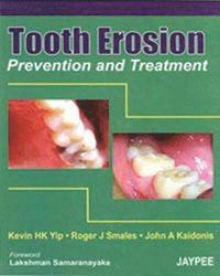 bokomslag Tooth Erosion Prevention and Treatment