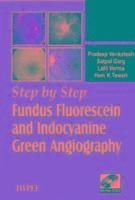 bokomslag Step by Step (R) Fundus Fluorescein and Indocyanine Green Angiography