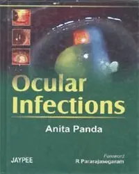 Anita Panda - Ocular Infection, Inbunden. Tillgänglighet: Tillfälligt slut