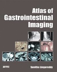 bokomslag Atlas of Gastrointestinal Imaging