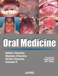 Satish Chandra, Shaleen Chandra, Girish Chandra, R Kamala - Oral Medicine, Häftad