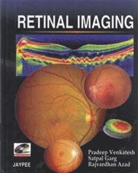 bokomslag Retinal Imaging