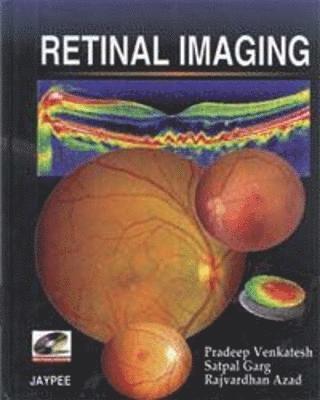 Retinal Imaging 1
