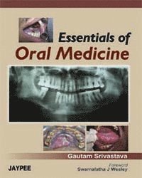 Gautam Srivastava - Essentials of Oral Medicine, Häftad