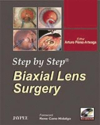 bokomslag Step by Step: Biaxial Lens Surgery