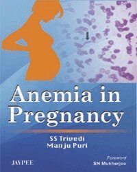 Shubha Sagar Trivedi, Manju Puri - Anemia in Pregnancy, Häftad